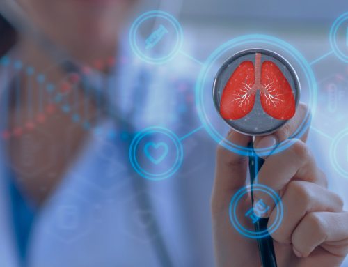 Lucem Health Launches Reveal for Lung Cancer, A New AI-Driven Solution to Accelerate Lung Cancer Screening for At-Risk Patients