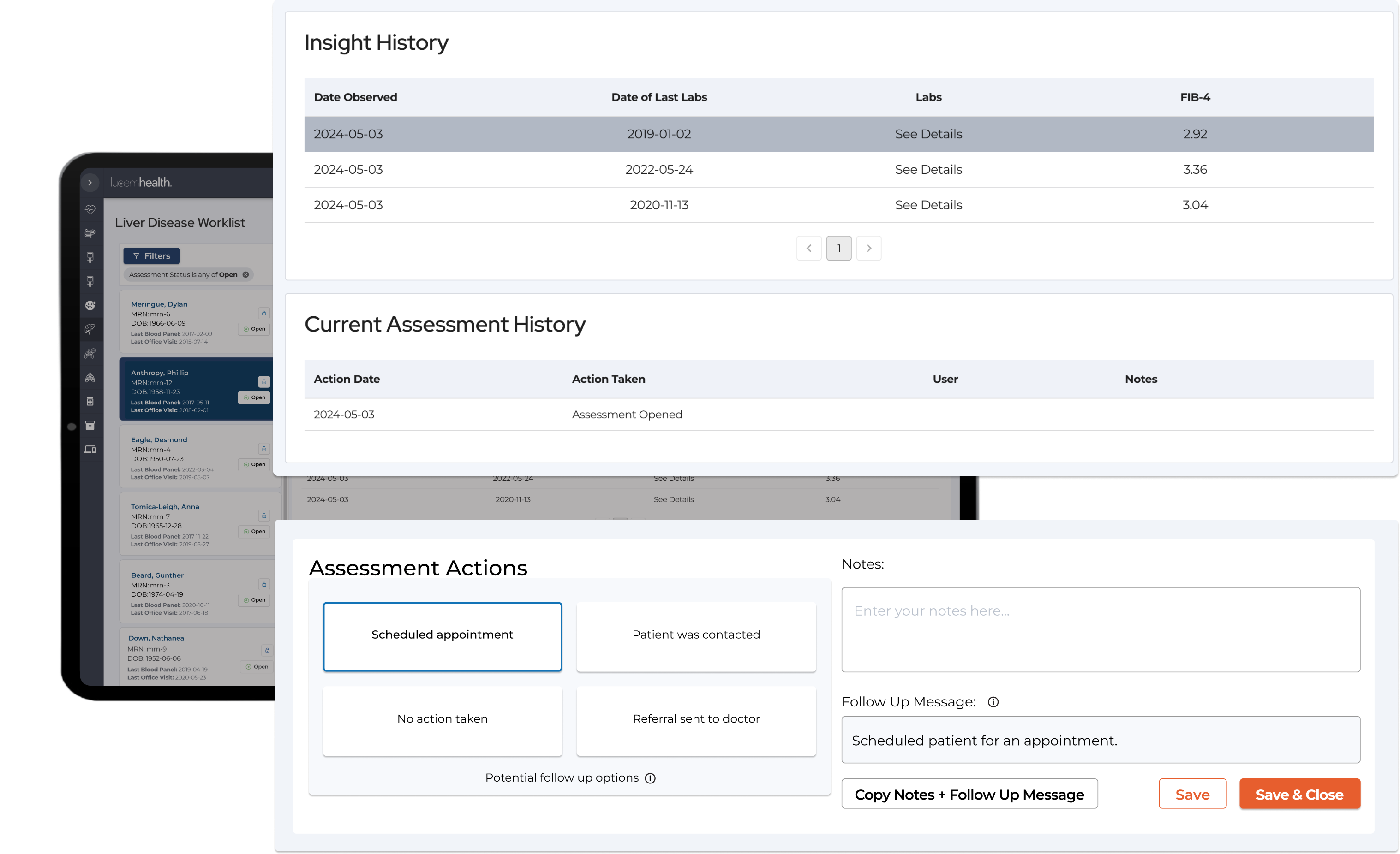 Reveal for Liver Disease Assessment Detail View