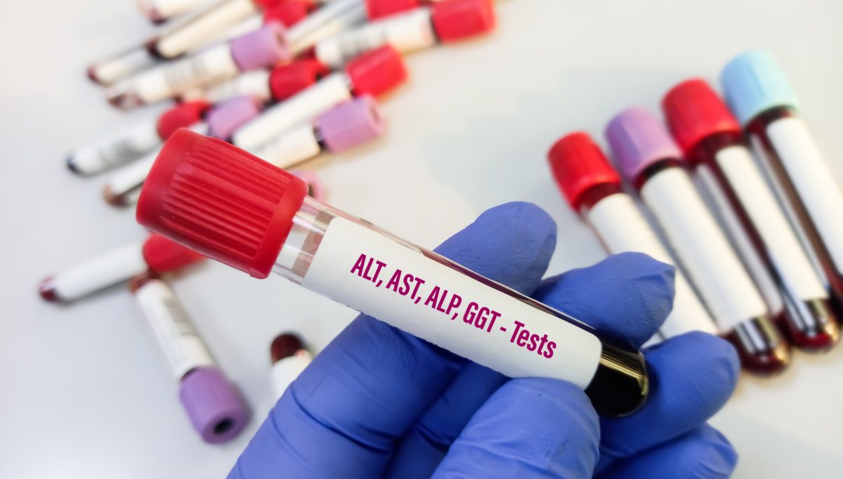 FIB4 Score Exploring Current Limitations & Improvement Opportunities