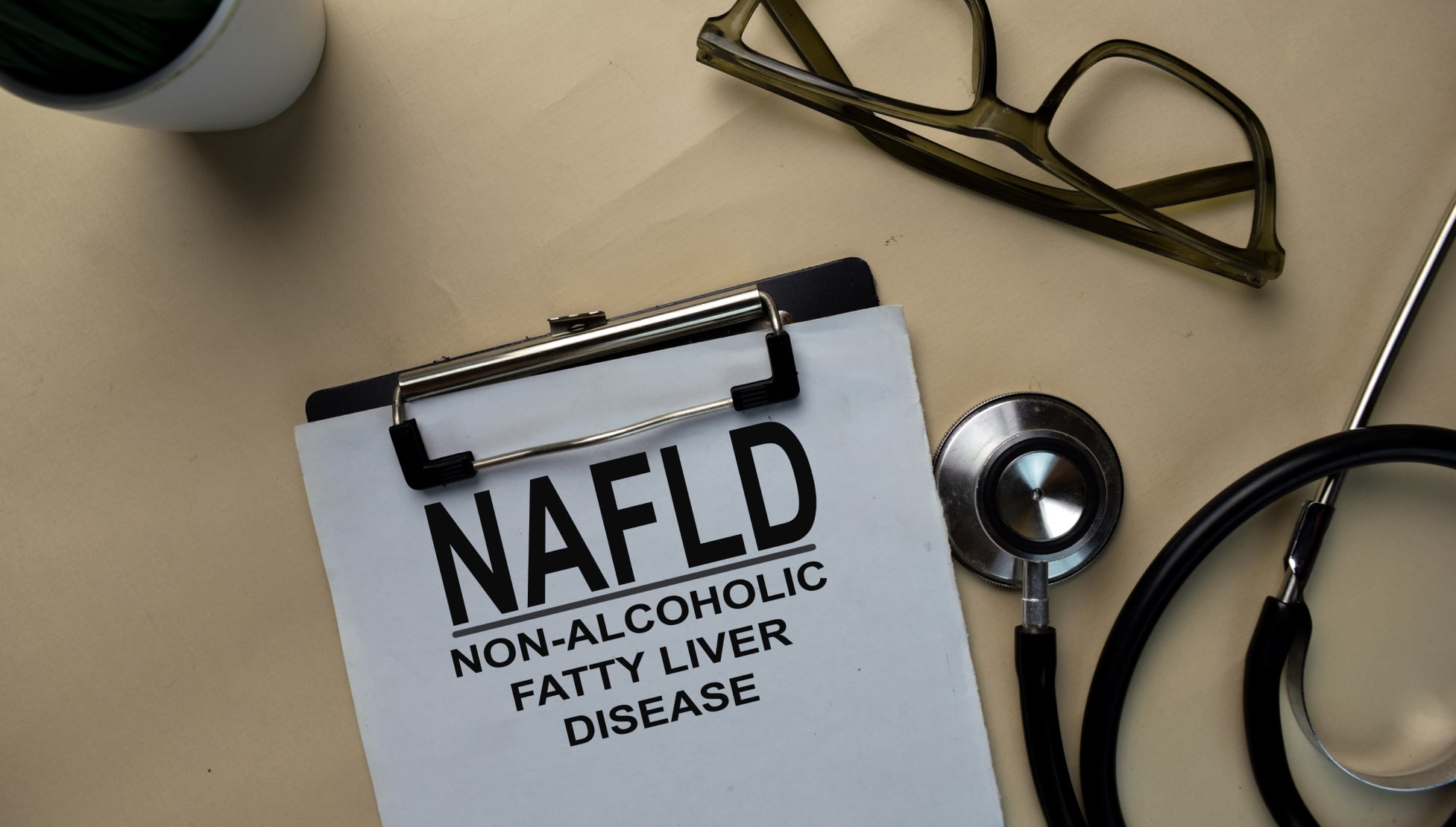 NAFLD Guidelines