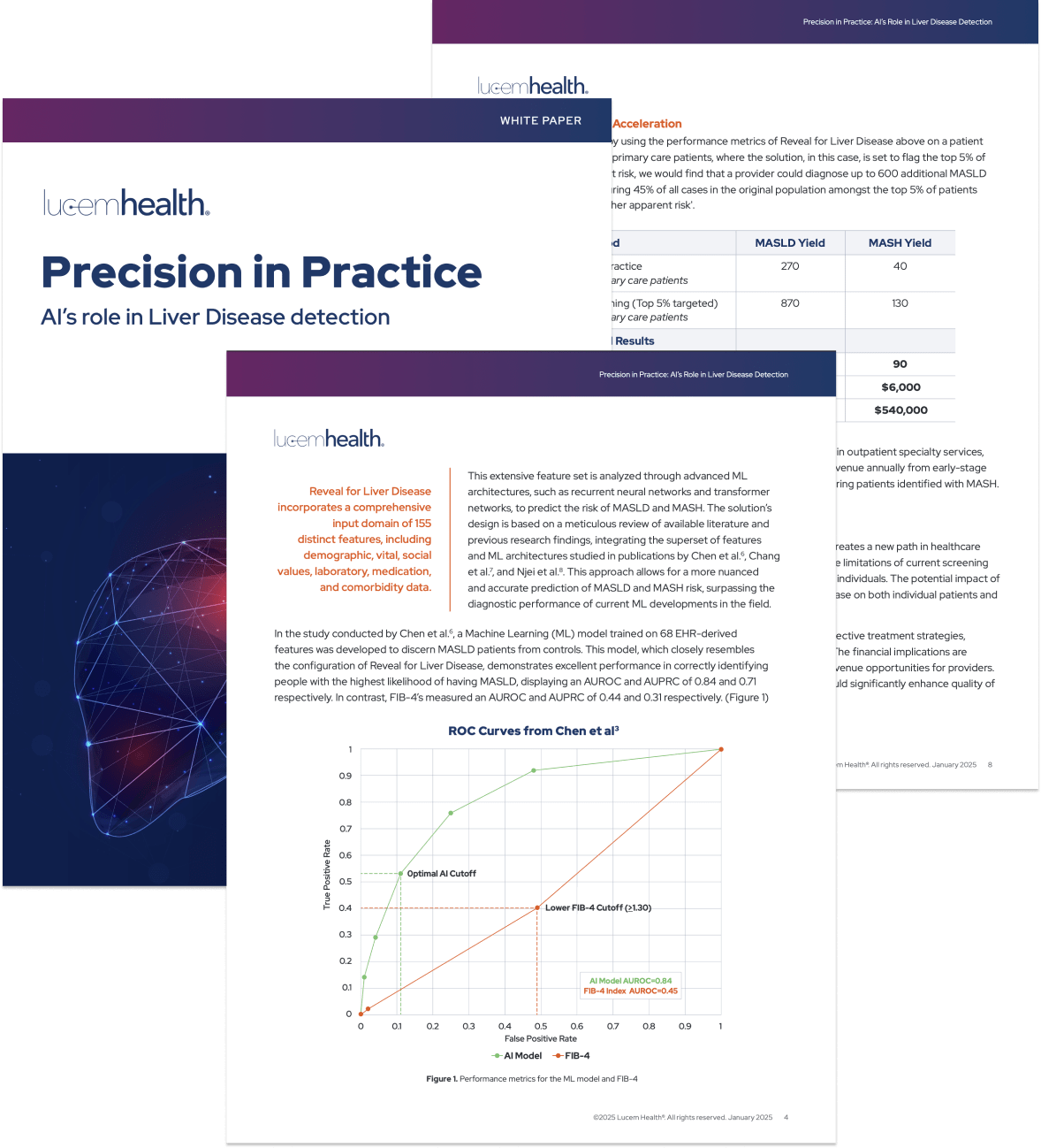 Liver Disease Detection White Paper